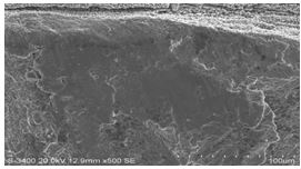 圖11-154 斷面A1、A2區(qū)邊沿微觀形貌